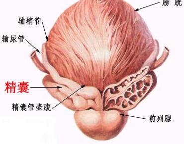 精囊炎挂什么科?该做哪些检查?